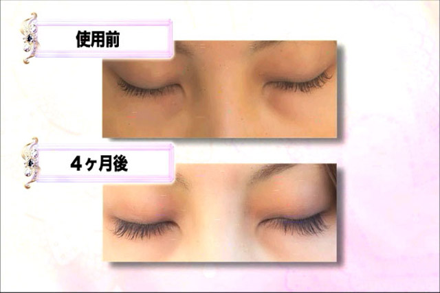 使用者インタビュー