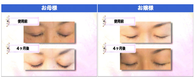 お母様とお嬢様へのインタビュー