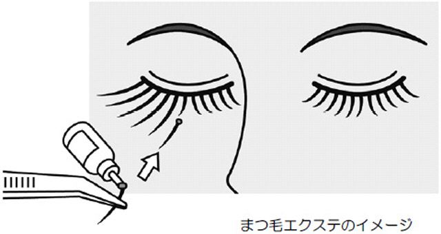 まつ毛エクステンションの危害